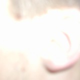 mOPTl